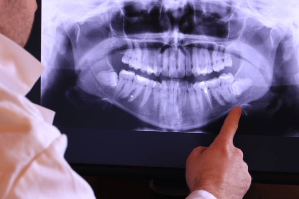 Best Teeth Whitening  in Gas City, IN