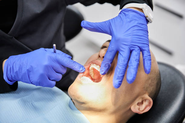Best Teeth Whitening  in Gas City, IN